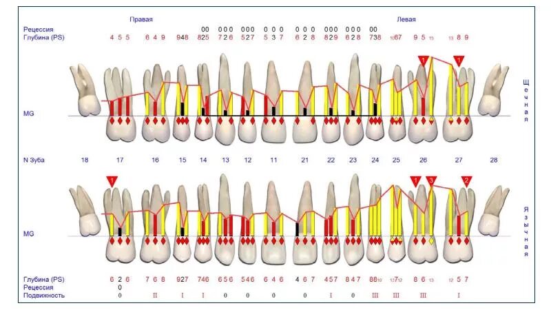 Сколько стоят зубы человека. Ширина фронтальных зубов. Размеры зубов. Размер зубов человека. Размер передних зубов человека.