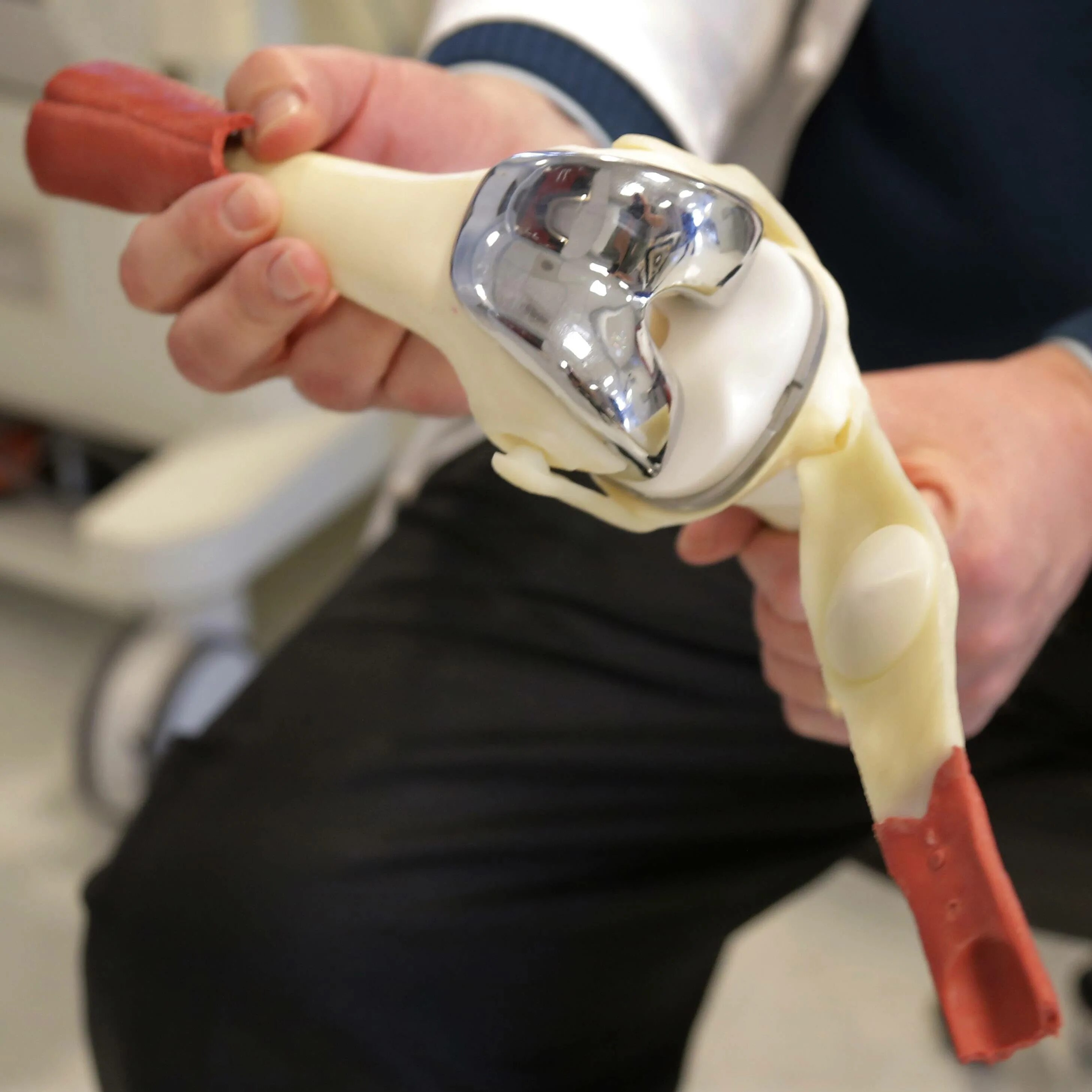 Dr. Robinson on Exactech Optetrak Total Knee Replacement System - YouTube