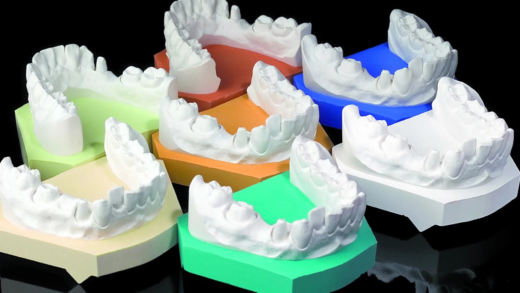 Изготовление разборной модели. Гипсовая модель зубов. Гипсовые модели челюстей. Гипсовые модели в стоматологии. Отливка гипсовых моделей.