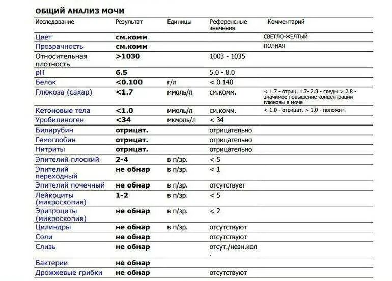 Анализ мочи показатели нормы. Норма показателей общего анализа мочи у женщин таблица. Норма клинического анализа мочи у мужчин таблица. Анализ мочи норма у женщин таблица.