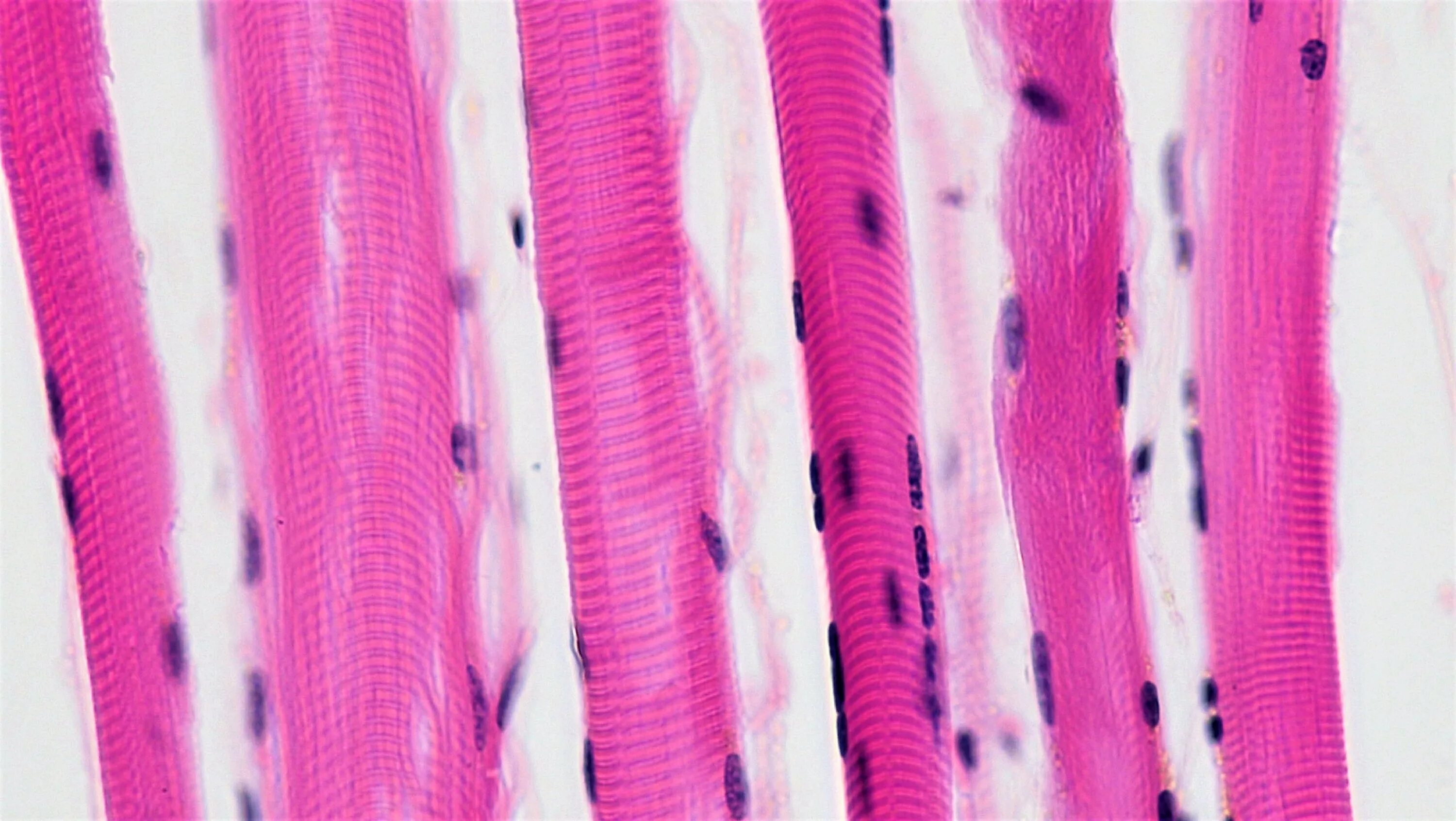 Клетки скелетной поперечно-полосатой мышечной ткани. Поперечно полосатая Скелетная ткань. Поперечнополосатая Скелетная мышечная ткань под микроскопом. Клетки скелетной поперечнополосатой мышечной ткани.