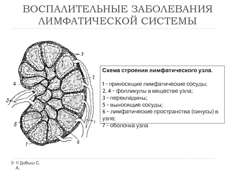 Лимфатический узел гистология схема. Схема лимфатического узла анатомия. Строение лимфатического узла гистология схема. Строение лимфатического узла гилус. Лимфоузлы структурны