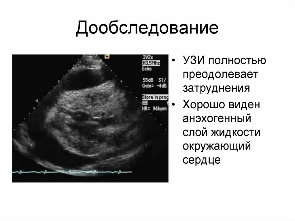 Узи полные органов. Анэхогенная жидкость ДЦК 36мм. УЗИ полностью. Анэхогенная структура УЗИ. Анэхогенное скопление жидкости.