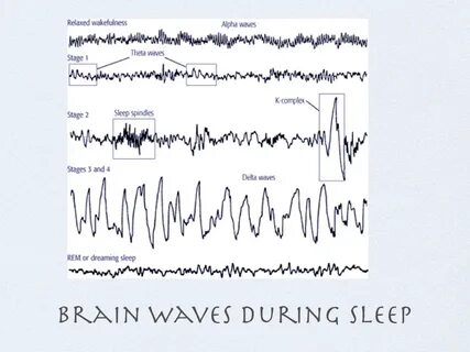 Slow wave