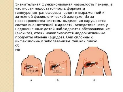 Печень у новорожденного