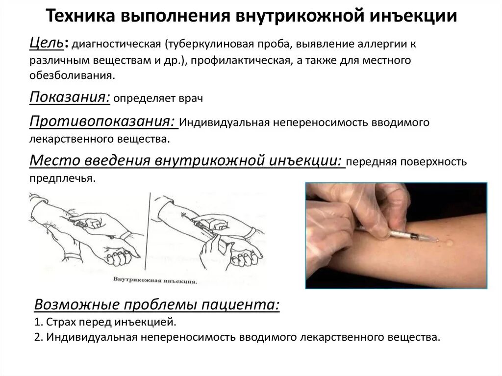 Подкожные инъекции техника выполнения. Внутрикожная инъекция алгоритм выполнения. Техника постановки внутрикожной инъекции алгоритм. Алгоритм проведения внутрикожной инъекции. Внутрикожное Введение лекарственных препаратов алгоритм.