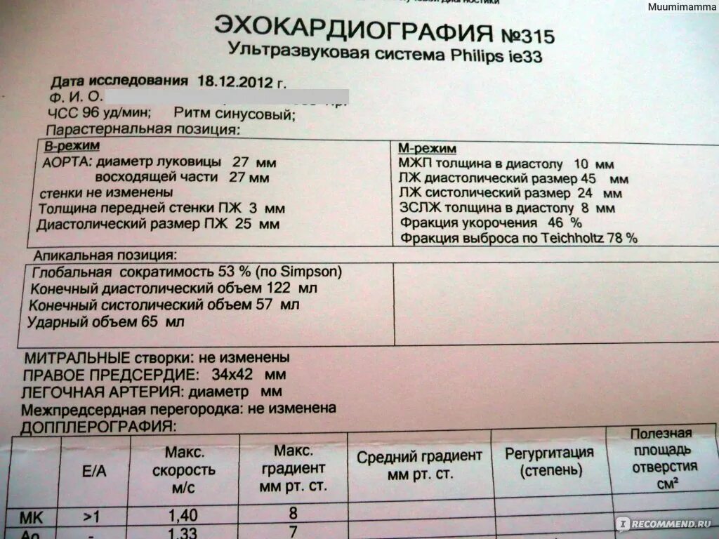 Эхокардиография сердца норма у взрослых в таблице Картинки РЕЗУЛЬТАТЫ ЭХО КГ