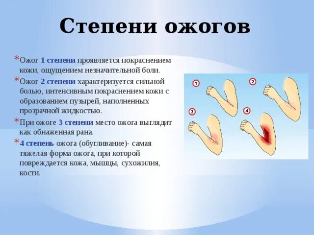 Установите соответствие степени ожога. Ожог 2 степени характеризуется. Степени степени ожогов.