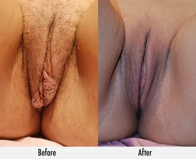 Vaginas Before Sex and after Sex XXX (70 photos) .