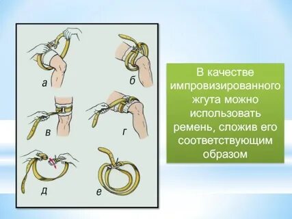 Жгут предложения