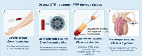 Мультфильмдердегі порно