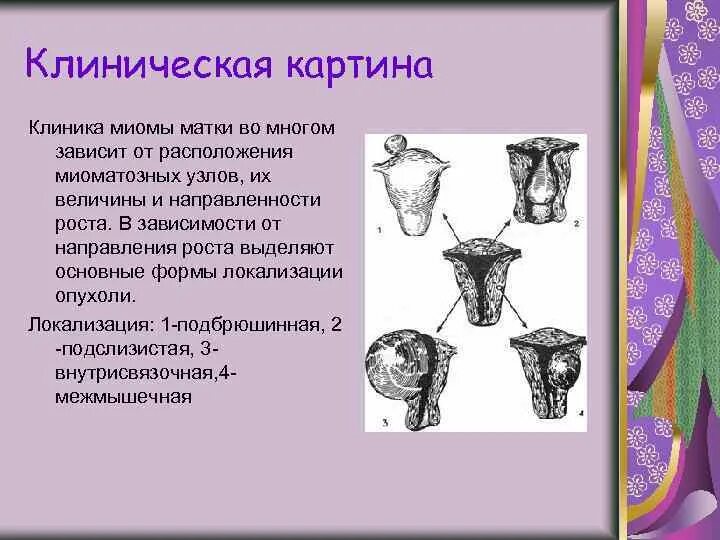 Что значит 4 тип миомы. Что значит 4 тип миомы