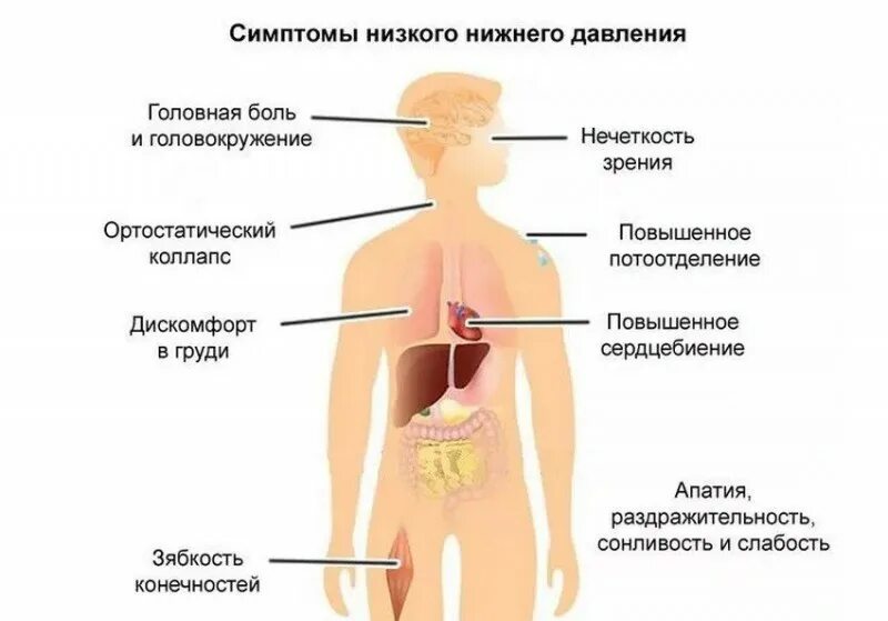 Низкое давление это. Медикаментозная гипотония мкб 10. Низкое давление симптомы. Пониженное давление си. При низкой давление симптомы.