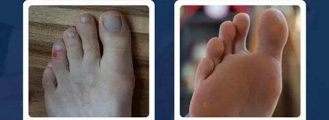 Пискадағы саусақтың үйдегі фотосы