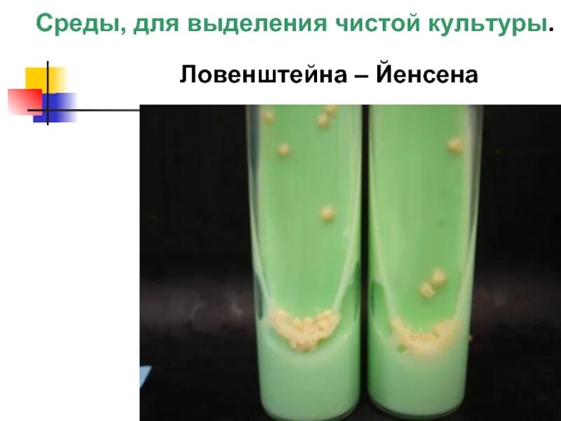 Возбудитель туберкулеза на среде Левенштейна Йенсена. Среда Левенштейна-Йенсена туберкулез. Микобактерии туберкулеза на жидких средах. Левенштейна Йенсена рост.