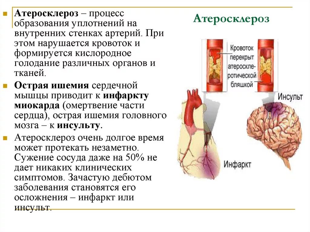 Заболевания артериальных сосудов. Причины заболевания атеросклероза. Атеросклеротическое поражение сосудов.