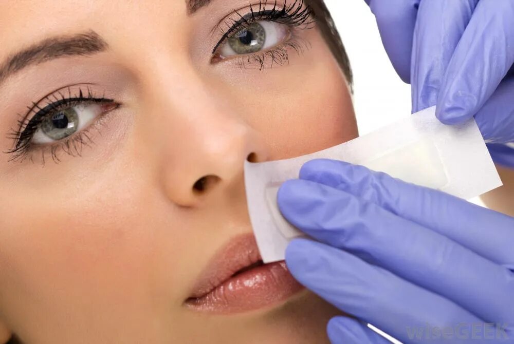 Лазерная эпиляция верхней губы. Лазерная эпиляция верхней губы. Эпиляция верхней. Восковая депиляция лица. Депиляция лица.