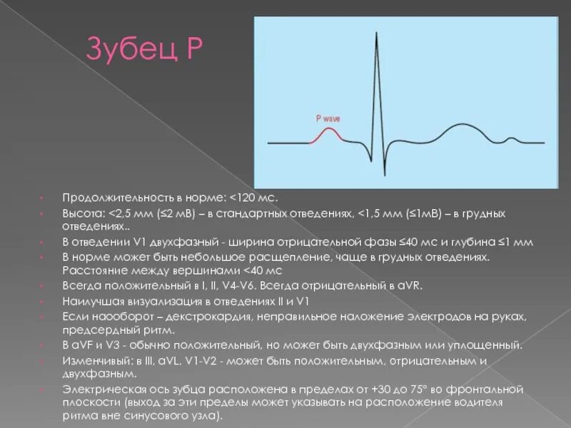 Амплитуда qrs. Продолжительность комплекса qrs на экг в норме составляет. длительность комплекса qrs в норме. расширение комплекса qrs на экг. комплекс qrs на экг норма.