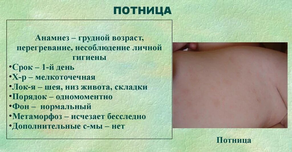Норма кожи у детей. Потница у новорожденных детей.