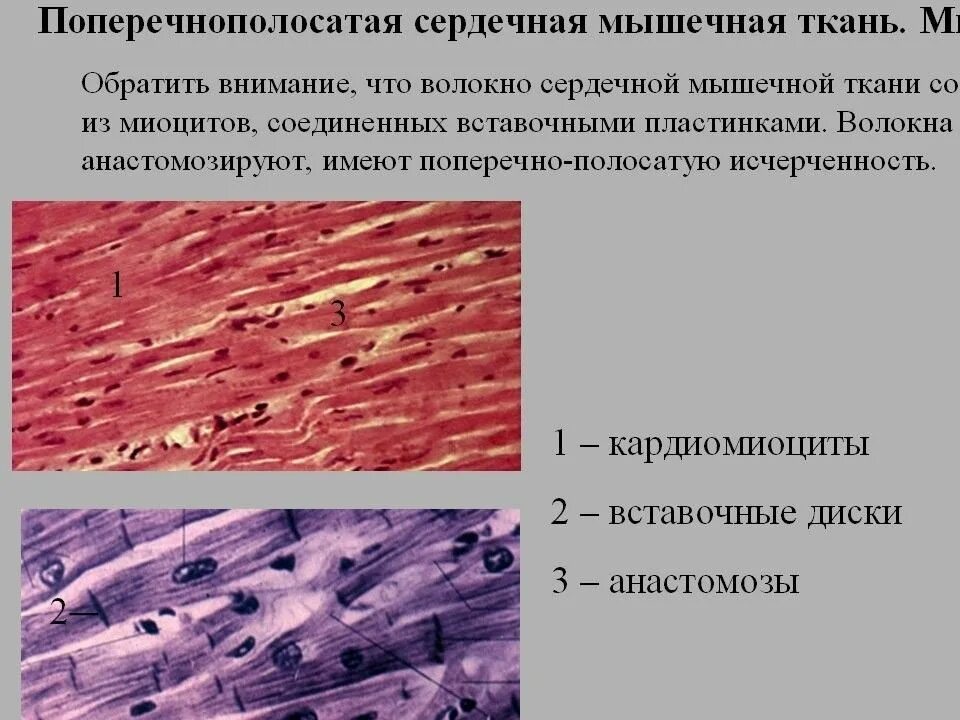 Миокард латынь. Поперечнополосатая сердечная мышечная ткань препарат. Сердечная мышечная ткань гистология препарат. Поперечнополосатая Скелетная мышечная ткань препарат. Поперечнополосатая сердечная мышечная ткань миокард.