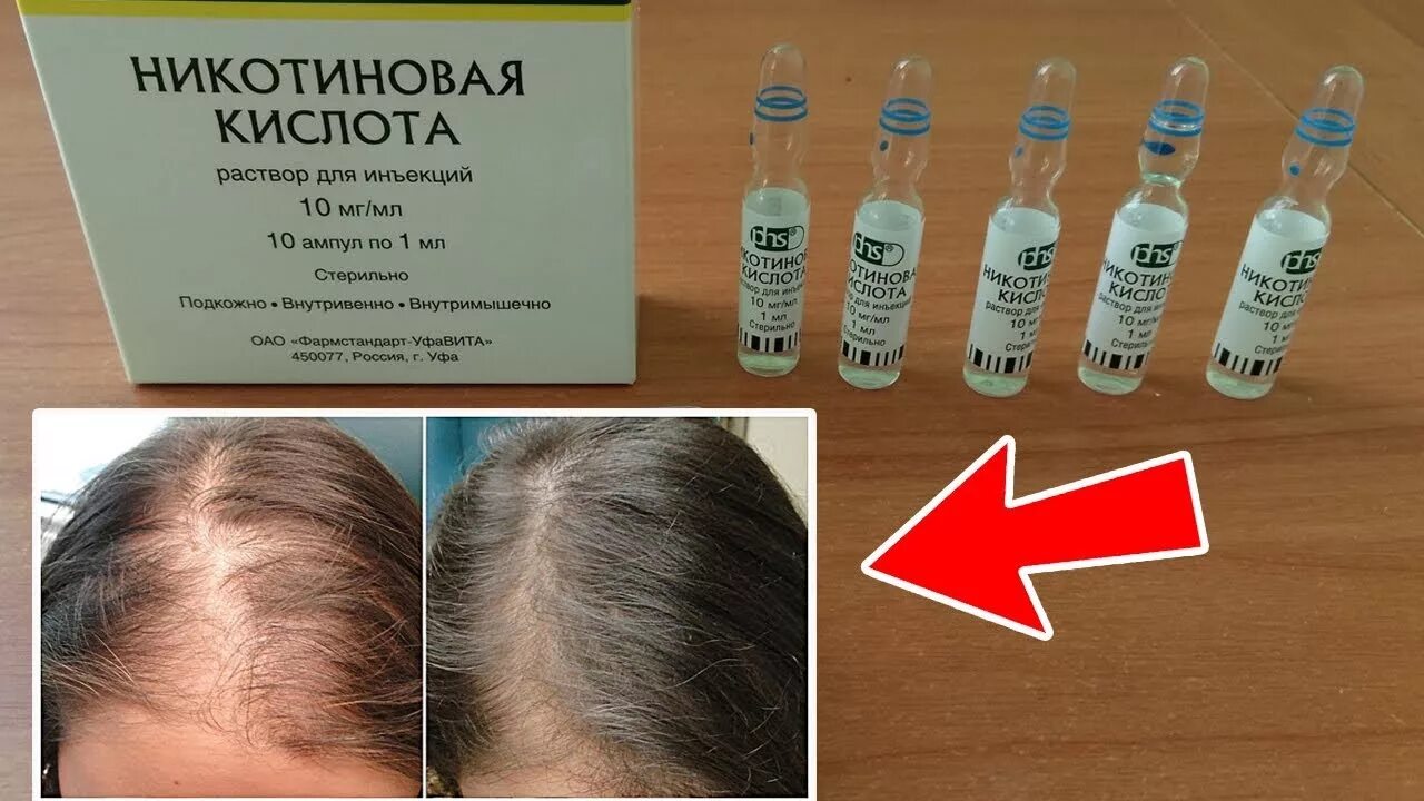Никотиновая кислота для волос. Никотиновая кислота для волос втирать. Никотиновая кислота для волос в ампулах. Никотиновая кислота для волос втирать. Никотиновая кислота для волос в ампулах.