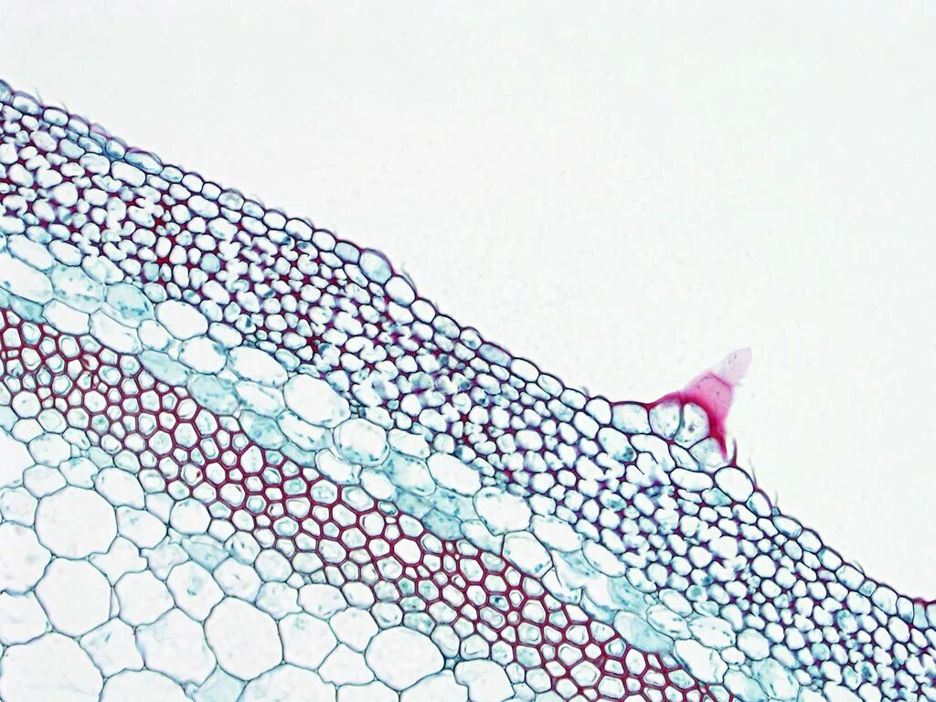 Микроскопия. Collenchyma and Sclerenchyma. Микроскопия склеренхима. Колленхима микроскопия. Уголковая колленхима микроскоп.