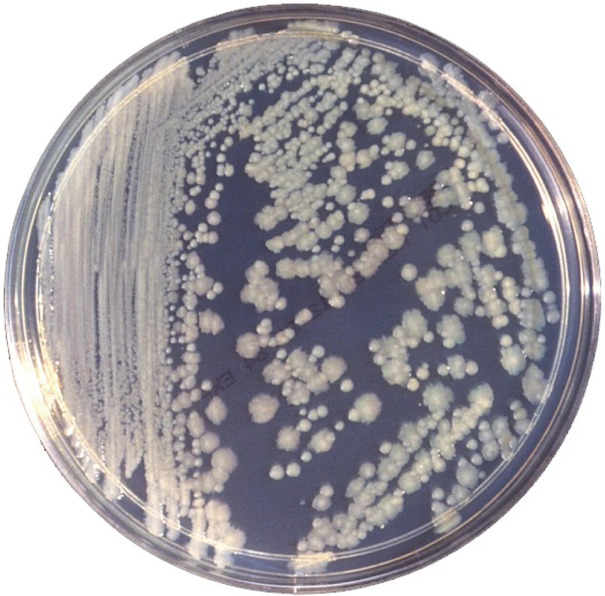 Enterobacter cloacae что это. Энтеробактер cloacae. enterobacter gergoviae что это такое. клебсиелла cloacae. энтеробактерии рода enterobacter.