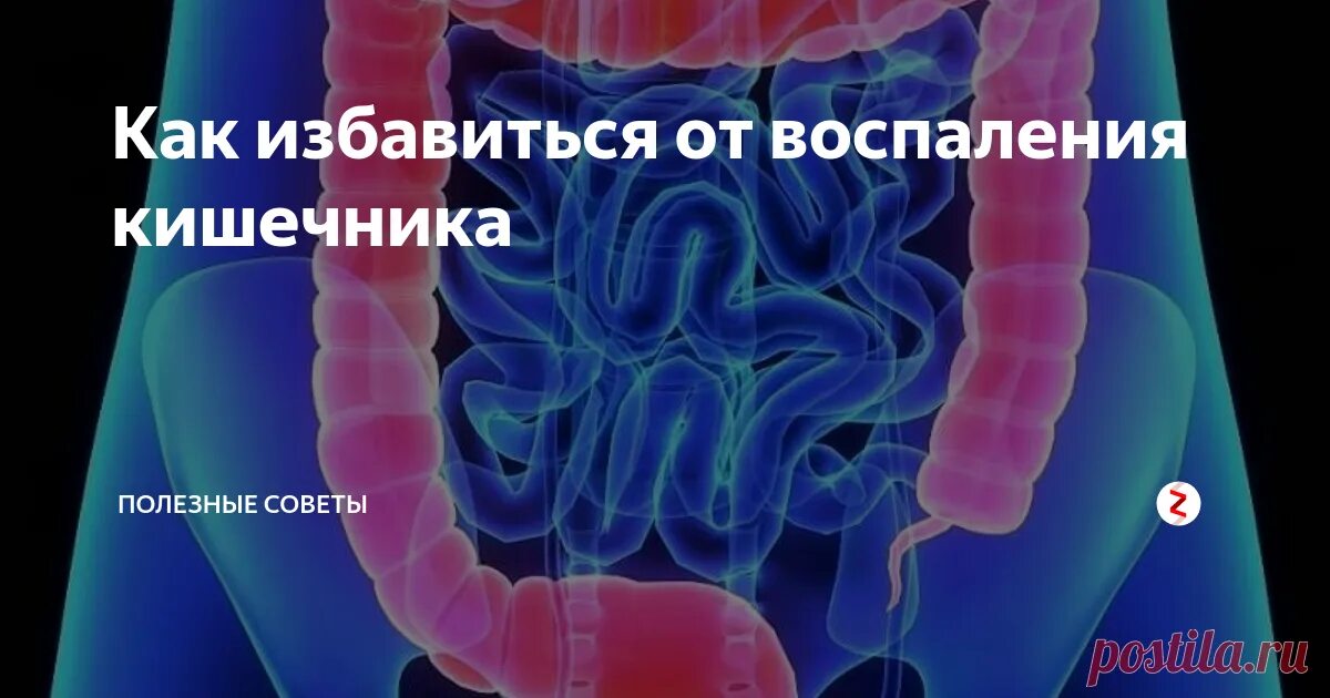 Лечение воспаления толстого и. Воспалительные процессы в кишечнике. От воспаления кишечника.