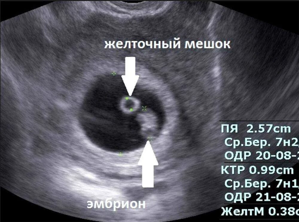 Как выглядит срока
