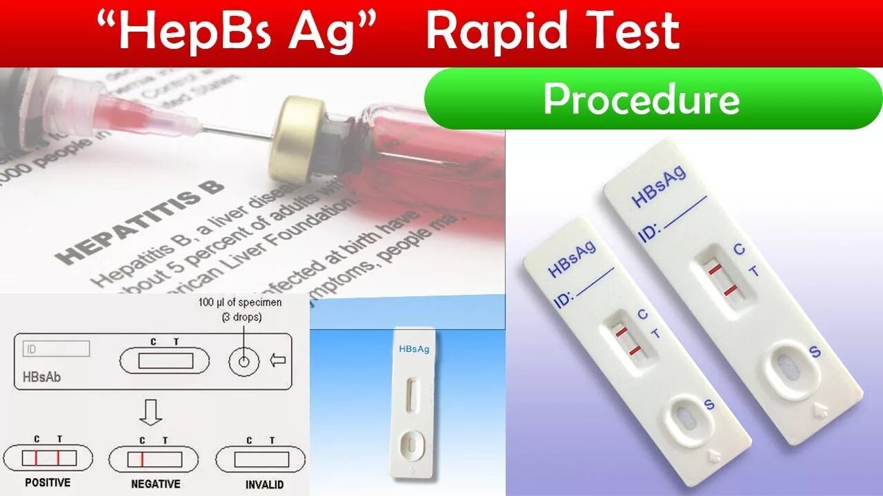 Antigen Rapid Test Kit №1. Положительный экспресс тест. Экспресс теста на антиген. Antigen Rapid Test Результаты.