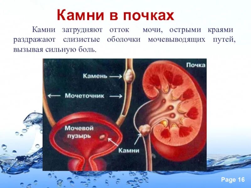 Предупреждение заболеваний почек питьевой режим. Предупреждение заболеваний почек питьевой режим 8 класс. Заболевание почек презентация. Была острая край