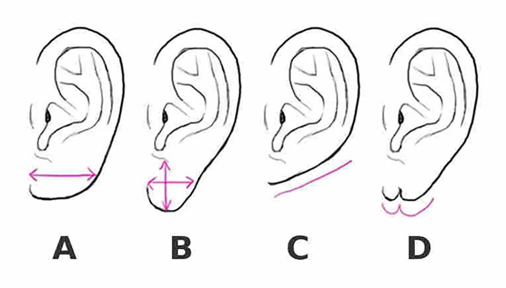 Форма мочки ушной раковины. Форма мочек ушей и характер человека. Физиогномика мочки ушей.