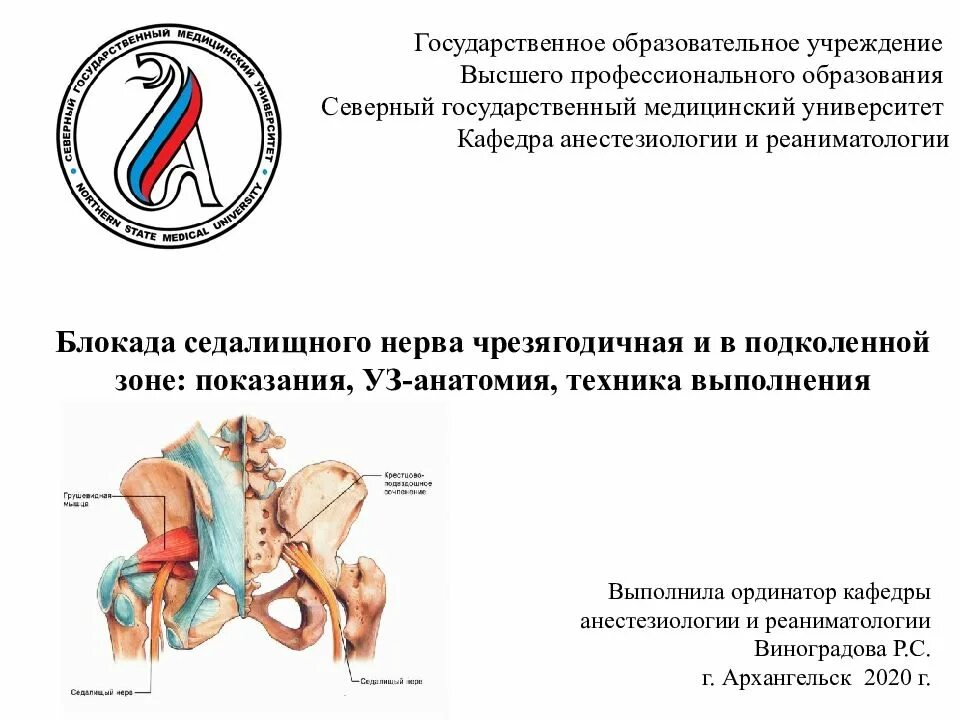 Блокада при защемлении седалищного нерва. Технику блокады седалищного нерва. Блокада зажим седалищного нерва. Блокада седалищного нерва показания. Проводниковый блок седалищного нерва.