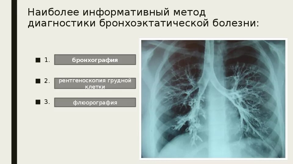 Бронхоэктатическая болезнь диагноз. Метод исследования при бронхоэктатической болезни. Бронхоэктатическая болезнь инструментальные исследования. Информативный метод диагностики бронхоэктазов. ФВД при бронхоэктатической болезни.