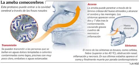 Que es la