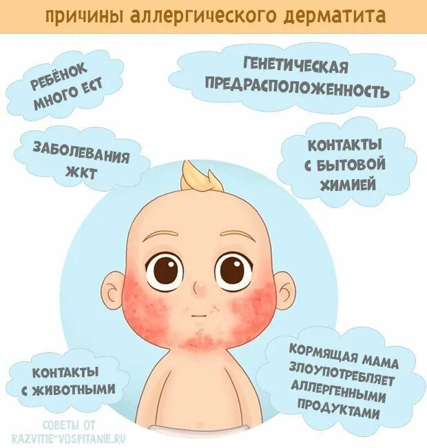Атопический дерматит причины у ребенка 1 год. Атопический дерматит причины у детей 5 лет. Атопический дерматит у детей 2 года. Атопический дерматит у ребенка 2.5 года.
