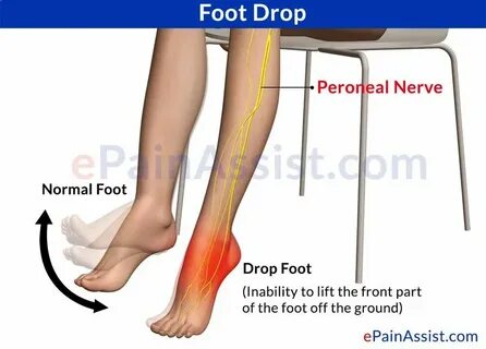 Foot on off