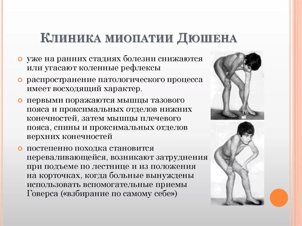 Что вызывает двигательную тошноту