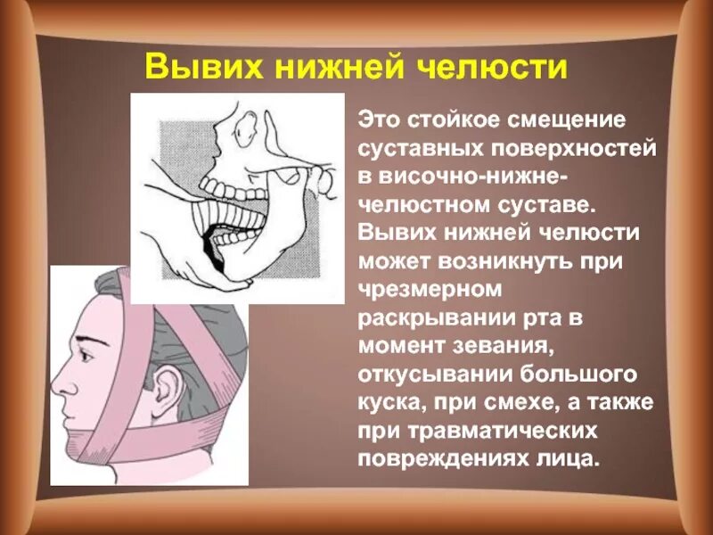 Смещается челюсть