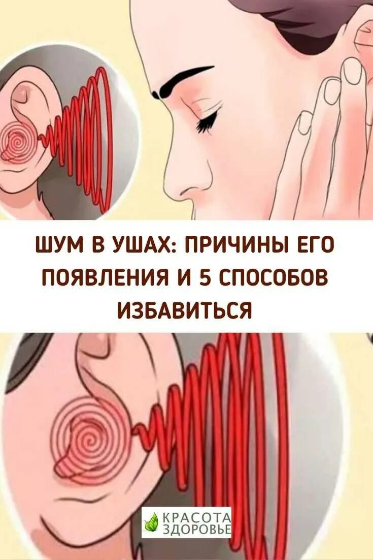 Как вылечить шум в ушах. Шум в ушах. шум в ушах причины. шумит в ухе причины. шум в ушах причины причины.
