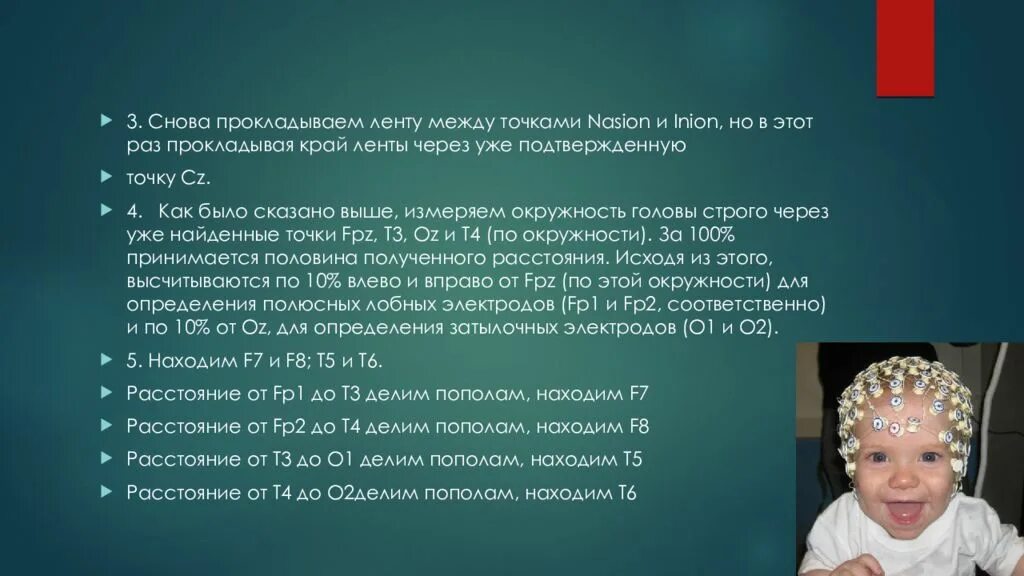 Ээг 3 лет. ЭЭГ детям. ЭЭГ ребенку 2 года. ЭЭГ головного мозга ребенку. Электроэнцефалограмма ребенка 2 года.