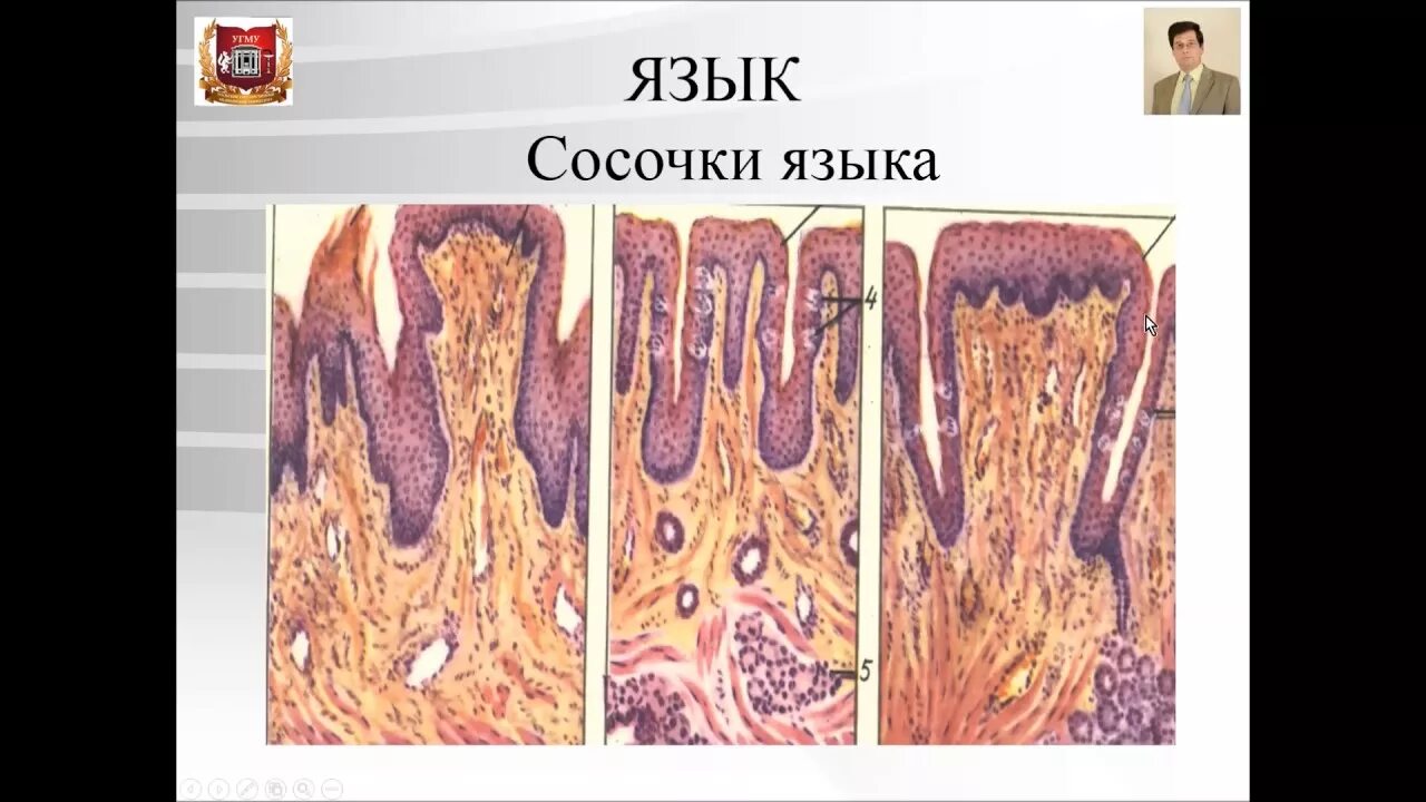 Строение языка гистология. Строение ротовой полости гистология. желобоватый сосочек языка гистология. листовидный сосочек гистология. язык гистология препарат.