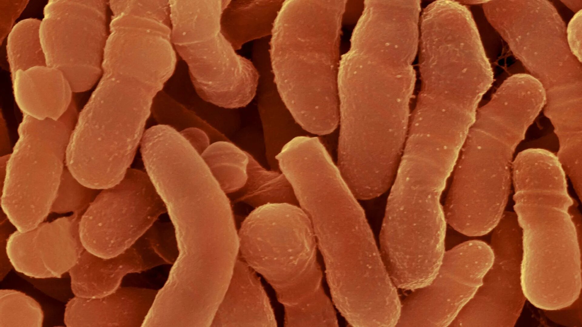 Микробио. Бактерии. Микроорганизмы. Оранжевые бактерии. Оранжевые микроорганизмы.