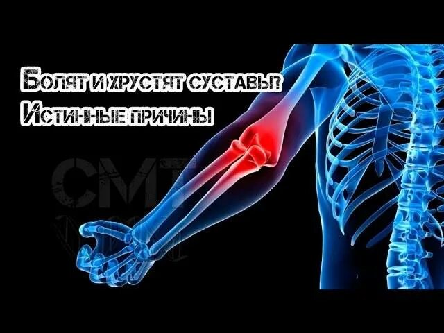 Хрустят суставы что принимать. Хруст суставов причины. Физиология хруста суставов позвоночника. Хрустят суставы по всему телу причины.