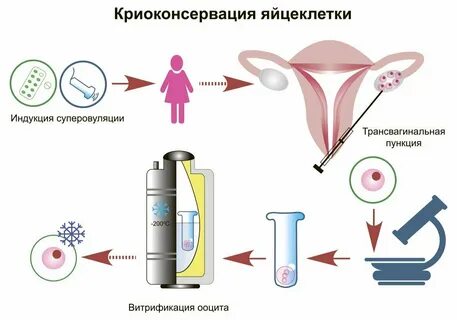 Зачем замораживать яйцеклетки