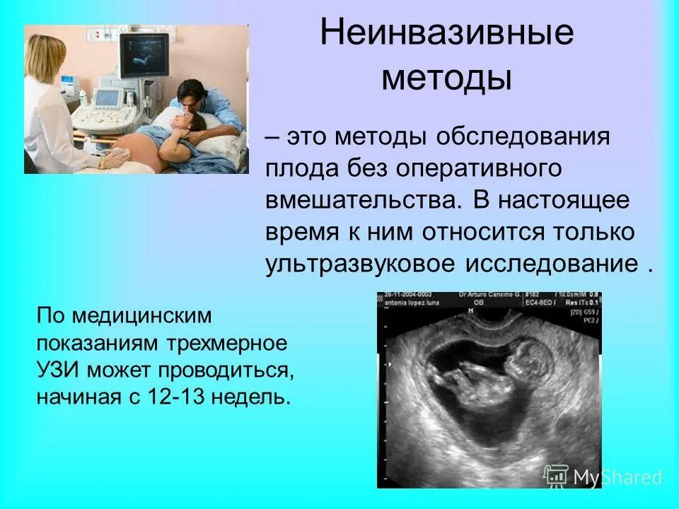 узи дверьченко