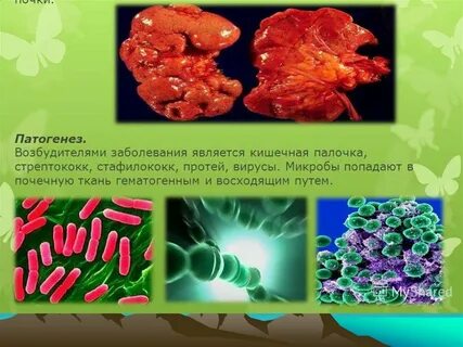 Хронического возбудитель