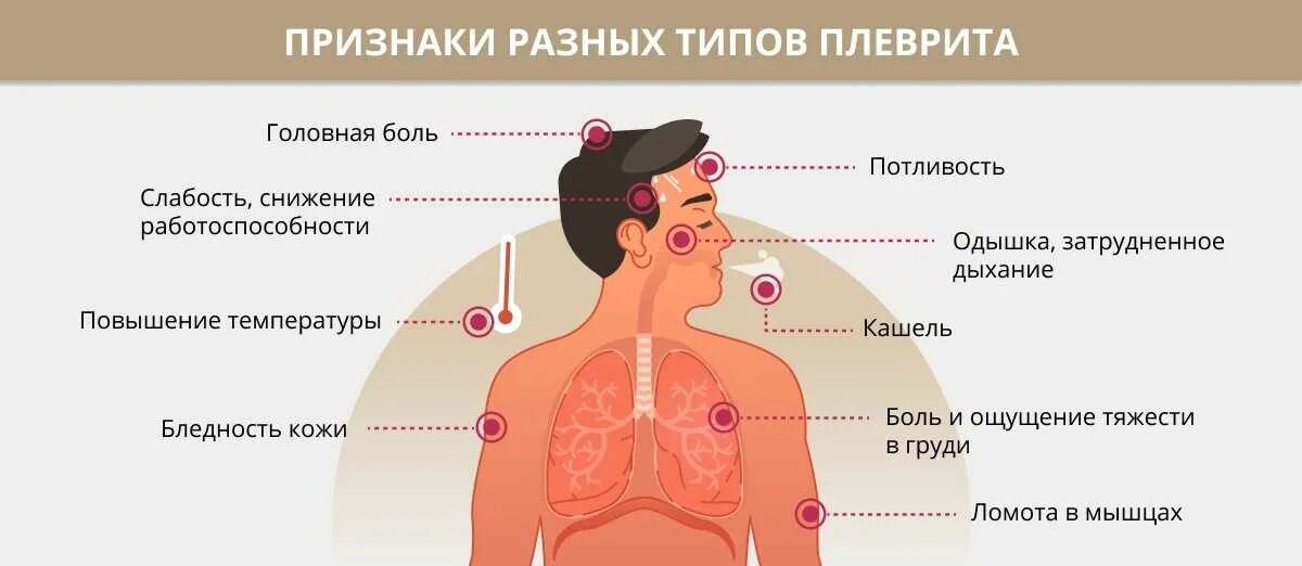 Сильный кашель потливость. Локализация боли в груди. Заболевания которые приводят к плевриту.