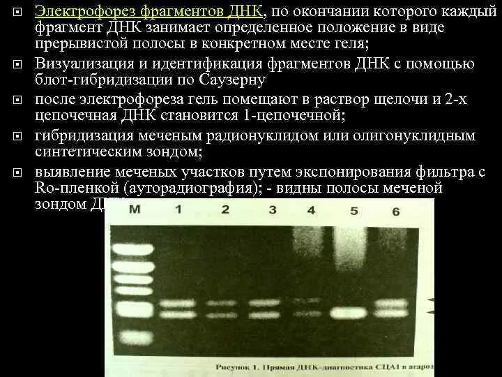 ПЦР электрофорез в агарозном геле. Электрофорез ДНК В агарозном геле. Метод горизонтального электрофореза в агарозном геле. Гель электрофорез ПЦР. Фотограф электрофорез текст песни