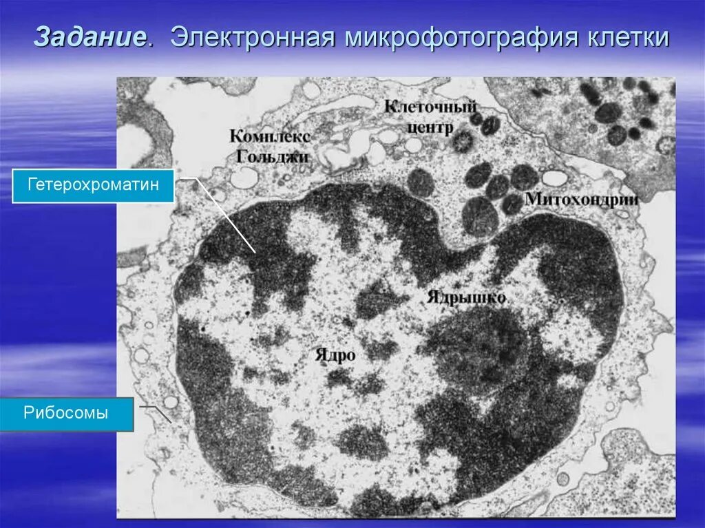 Какой органоид изображен на микрофотографии